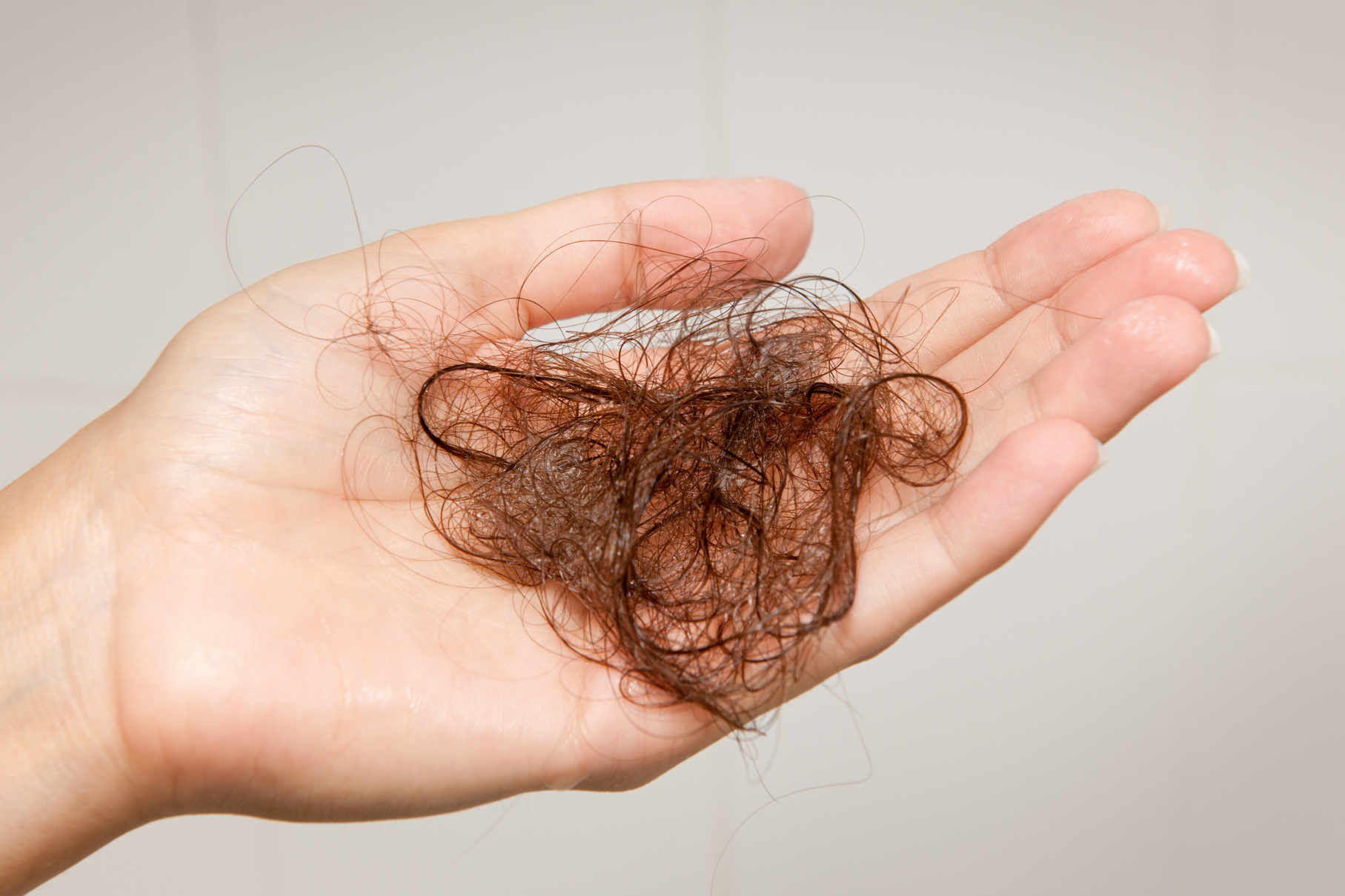 Hair Loss - Woman holding up a Hairball (XXXL)